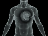 Miażdżyca serca - przyczyny i leczenie niedokrwienia serca